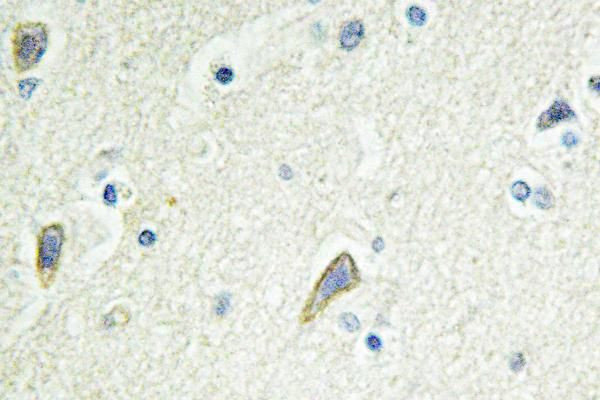 EphB4 Antibody in Immunohistochemistry (Paraffin) (IHC (P))