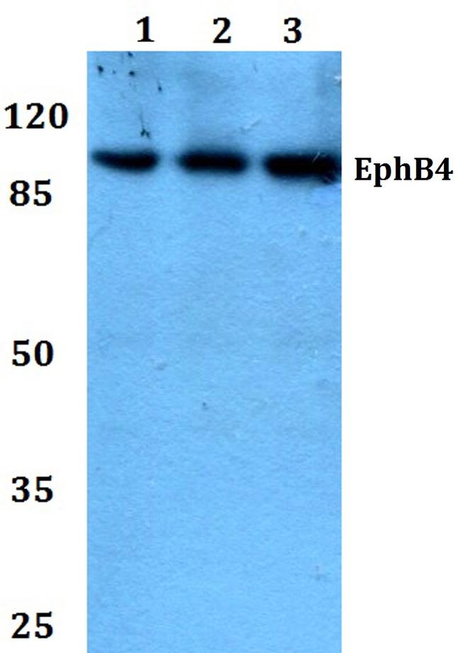 EphB4 Antibody in Western Blot (WB)