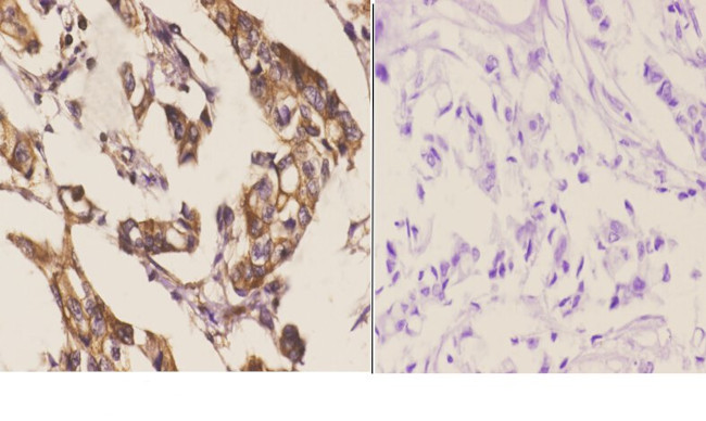 HSF2 Antibody in Immunohistochemistry (Paraffin) (IHC (P))