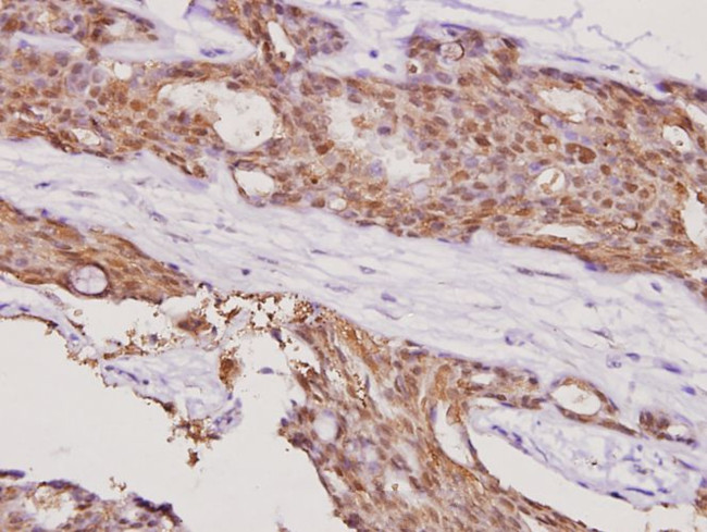 SMAD4 Antibody in Immunohistochemistry (Paraffin) (IHC (P))