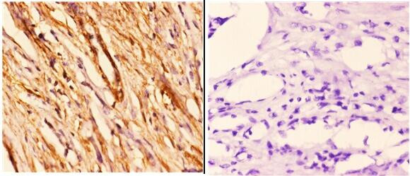 14-3-3 theta Antibody in Immunohistochemistry (Paraffin) (IHC (P))