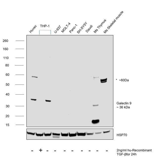 Galectin 9 Antibody in Western Blot (WB)