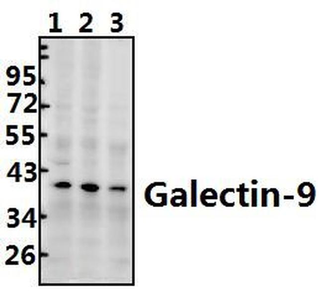 Galectin 9 Antibody in Western Blot (WB)