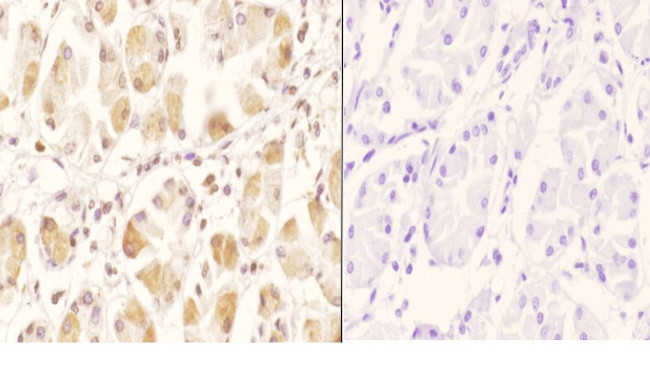 GCN5 Antibody in Immunohistochemistry (Paraffin) (IHC (P))