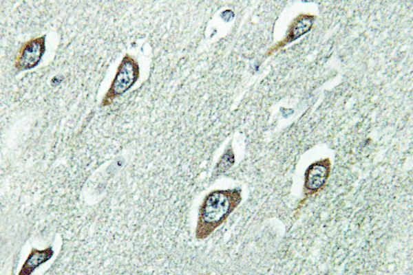 Calmodulin Antibody in Immunohistochemistry (Paraffin) (IHC (P))