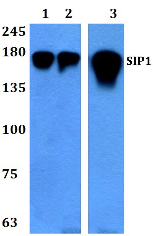 ZEB2 Antibody in Western Blot (WB)