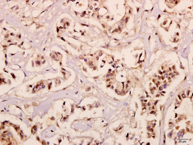 NDUFB10 Antibody in Immunohistochemistry (Paraffin) (IHC (P))