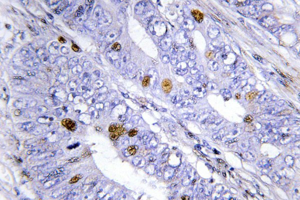 NR4A1 Antibody in Immunohistochemistry (Paraffin) (IHC (P))