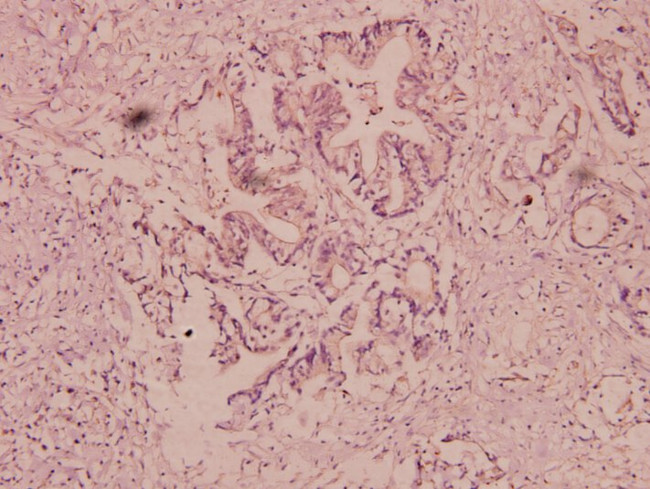 Urokinase Antibody in Immunohistochemistry (Paraffin) (IHC (P))