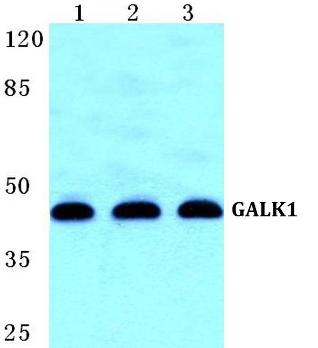 GALK1 Antibody in Western Blot (WB)