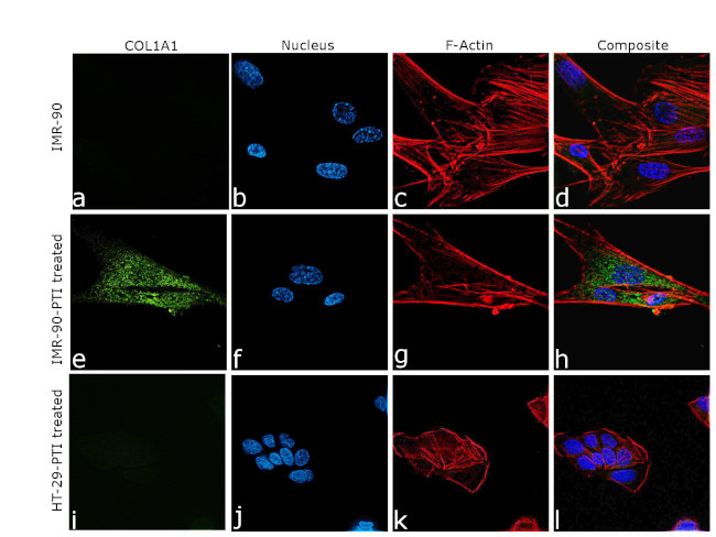 COL1A1 Antibody in Immunocytochemistry (ICC/IF)