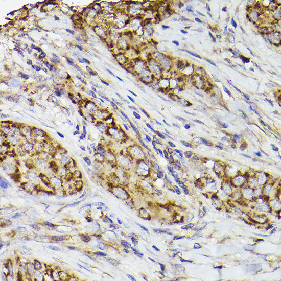 COX2 Antibody in Immunohistochemistry (Paraffin) (IHC (P))