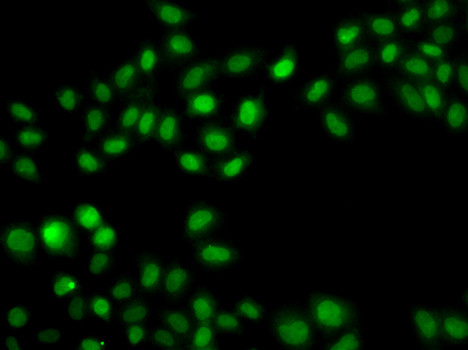 SULT2B1 Antibody in Immunocytochemistry (ICC/IF)