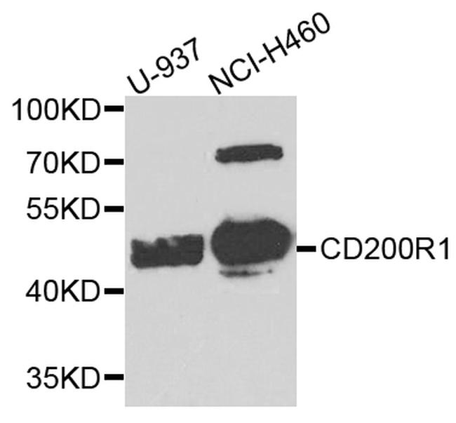 CD200R Antibody in Western Blot (WB)