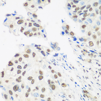 UAP56 Antibody in Immunohistochemistry (Paraffin) (IHC (P))