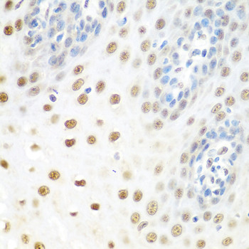 UAP56 Antibody in Immunohistochemistry (Paraffin) (IHC (P))