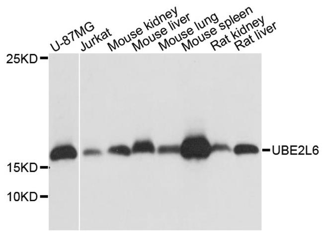 UBE2L6 Antibody in Western Blot (WB)