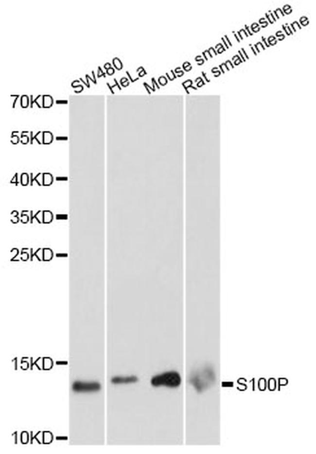 S100P Antibody in Western Blot (WB)