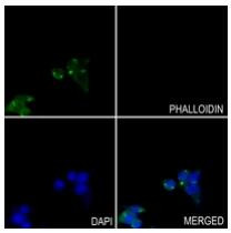 GOT1 Antibody in Immunocytochemistry (ICC/IF)