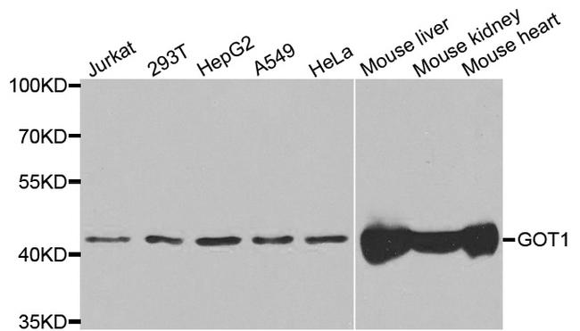 GOT1 Antibody in Western Blot (WB)