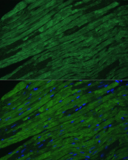 Cardiac Troponin I Antibody in Immunocytochemistry (ICC/IF)