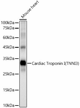 Cardiac Troponin I Antibody in Western Blot (WB)