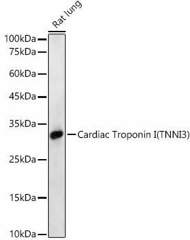 Cardiac Troponin I Antibody in Western Blot (WB)