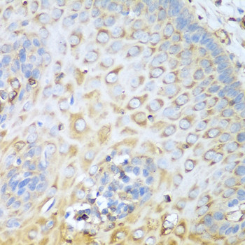 MYH9 Antibody in Immunohistochemistry (Paraffin) (IHC (P))