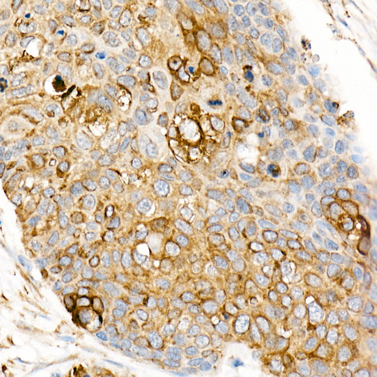 CD178 Antibody in Immunohistochemistry (Paraffin) (IHC (P))