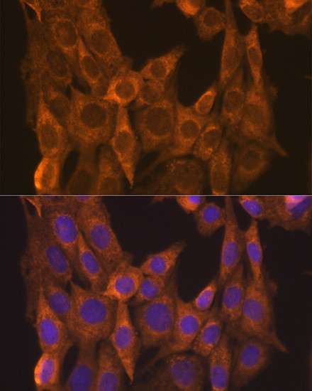 RARA Antibody in Immunocytochemistry (ICC/IF)