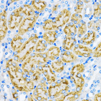 EEA1 Antibody in Immunohistochemistry (Paraffin) (IHC (P))