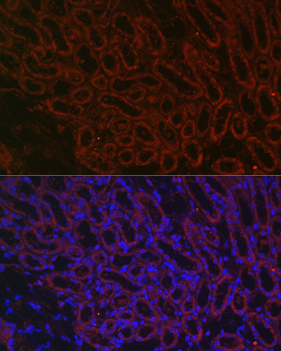 BMP-7 Antibody in Immunocytochemistry (ICC/IF)