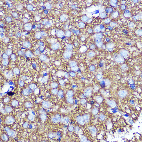 SNAP25 Antibody in Immunohistochemistry (Paraffin) (IHC (P))