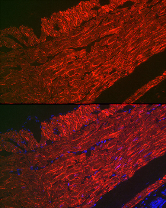 Alpha-Smooth Muscle Actin Antibody in Immunocytochemistry (ICC/IF)