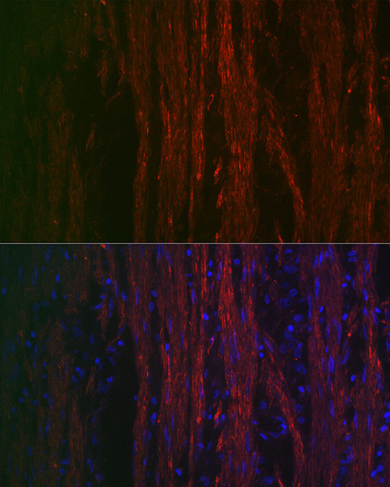 Alpha-Smooth Muscle Actin Antibody in Immunocytochemistry (ICC/IF)