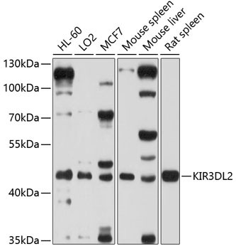 KIR3DL2 Antibody in Western Blot (WB)