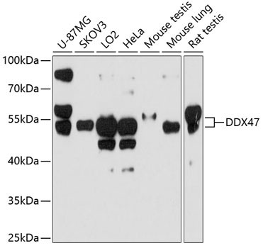 DDX47 Antibody in Western Blot (WB)