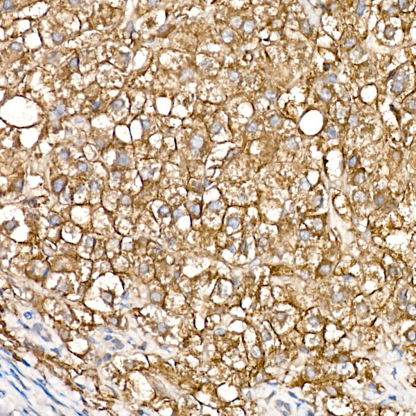 ZIP14 Antibody in Immunohistochemistry (Paraffin) (IHC (P))