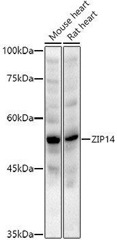 ZIP14 Antibody in Western Blot (WB)