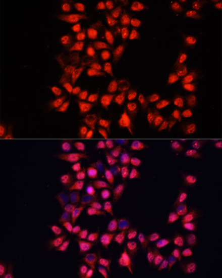 ADAM10 Antibody in Immunocytochemistry (ICC/IF)