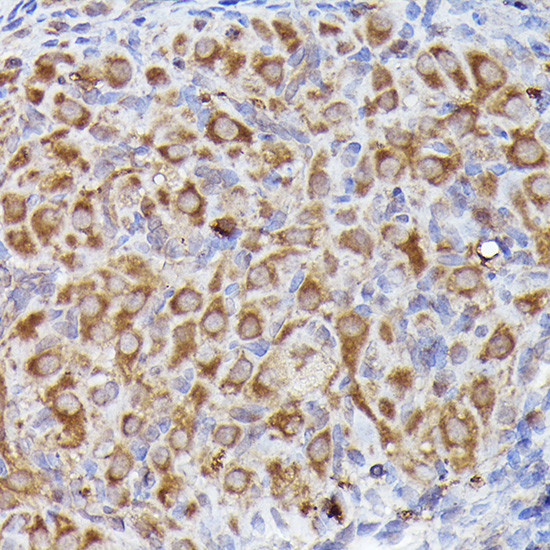 LGR5 Antibody in Immunohistochemistry (Paraffin) (IHC (P))