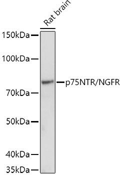 NGF Receptor Antibody in Western Blot (WB)