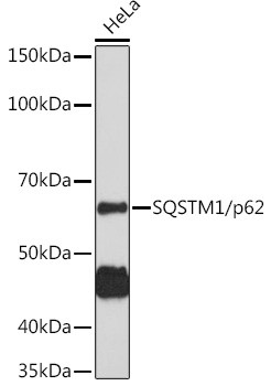 SQSTM1 Antibody in Western Blot (WB)