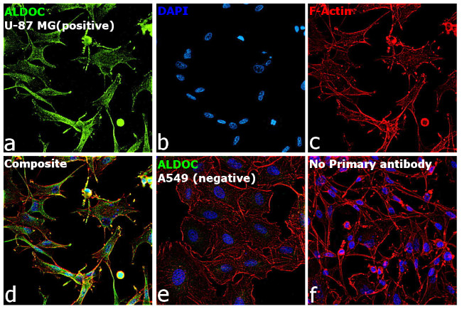 Aldolase C Antibody in Immunocytochemistry (ICC/IF)