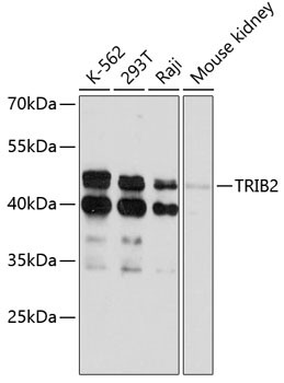 TRIB2 Antibody in Western Blot (WB)