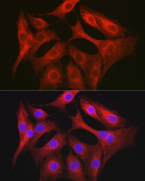 GTPBP9 Antibody in Immunocytochemistry (ICC/IF)