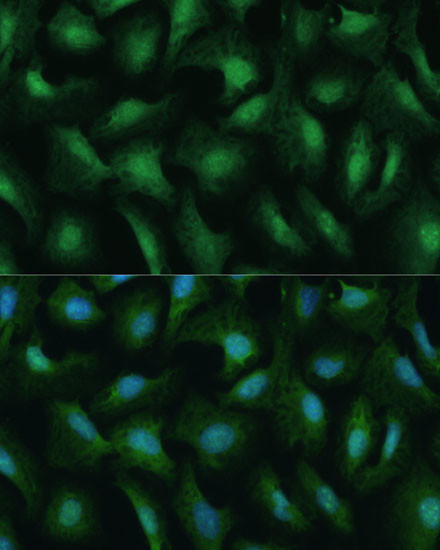 DDX3Y Antibody in Immunocytochemistry (ICC/IF)