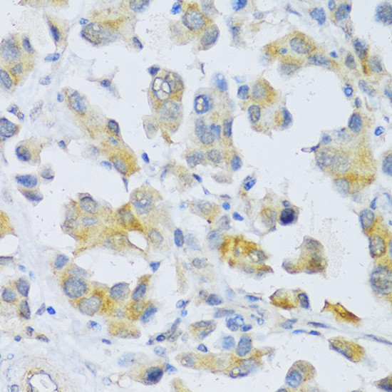 TGFBR2 Antibody in Immunohistochemistry (Paraffin) (IHC (P))
