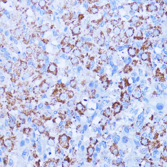 ISG15 Antibody in Immunohistochemistry (Paraffin) (IHC (P))