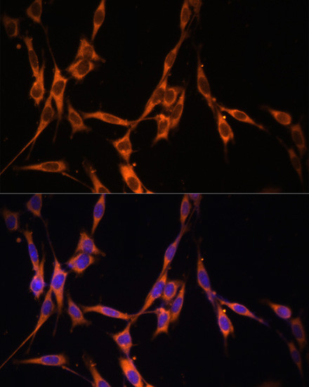 K-Ras Antibody in Immunocytochemistry (ICC/IF)